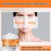 Turmeric Neck Firming Cream Neck Firming Cream Retinol Neck Cream for Sagging and Tightening Turmeric Neck Tightening Cream for Anti Aging Fade Fine Lines & Wrinkle Neck Double Chin Reducer-Face&Neck - Buy Online on GoSupps.com