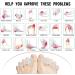 Toe Separators and Straighteners for Men and Women - Bunion Correction, Hammertoes, Plantar Fasciitis - Large Size White (1 Pair) - Buy Online on GoSupps.com