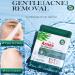 Tea Tree Face Masks - Organic Oil Control Bamboo Sheet Masks for All Skin Types | 5 PCS Natural & Fruit Extracts - Buy Online on GoSupps.com