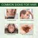Rosemary Oil for Hair Growth & Skin Care - Stimulates Growth, Improves Scalp Health, 2.02 Fl Oz - Buy Online on GoSupps.com