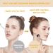 Morlake Professional 0.25mm Microneedle Derma Roller for Face & Body Skin Care - Individual Needles, Seamless Design - 1 Pack - Buy Online on GoSupps.com