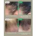 Yoauoop Tri-Phase Hair Oil - Bio-Active Formula Fortifies Roots Reduces Grease - Non-Greasy Lab Tested for Improved Density and Length 100% Natural Vegan 50 ml - Buy Online on GoSupps.com