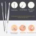 Boxoyx Blackhead Remover Tool Set - 10 Pcs Professional Pimple Extractor Kit for Acne Removal - Buy Online on GoSupps.com