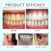 Bande Blanchiment Dentaire Bandes De Blanchiment Des Dents Blanchiments Dentaire Whitening Strips Eliminer Fumer Caf Soda Vin Tache Douces Pour Les Dents (3) - Buy Online on GoSupps.com