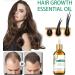 Rosemary Oil for Hair Hair Regrowth Serum Relieve Dry Damaged Hair to Target Hair Loss Rosemary Hair Serum for Hair Rapid Growth and Thickening Trengthen Hair Roots - Buy Online on GoSupps.com