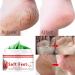 Pomegranate Hand and Foot Cream | Repair Dry Cracked Heels & Chapped Skin | Moisturizing Salve with Pomegranate Extract & Peppermint | International Shipping Available - Buy Online on GoSupps.com
