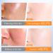 Whitening Niacinamide Serum - Face Serum for Women - Hyaluronic Acid Serum for Face - Skin Care for Dark Spot Correcting Glow Serum - Face Serum for Anti-Ageing and Wrinkles (30ml) - Buy Online on GoSupps.com