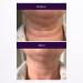 SBLA Neck Chin & Jawline Sculpting Wand XL | Night-Time Anti-Aging Serum for Firm & Lifted Skin | 0.7 Fl Oz | Collagen-Boosting Formula - Buy Online on GoSupps.com