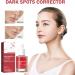 Ninnyi Dark Spot Correcting Serum Brightening Hydrating Face Ampoule for Acne Scars and Hyperpigmentation - Buy Online on GoSupps.com