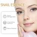 Snail Mucin Serum Snail Mucin Essence Snail Mucin Moisturiser Snail Serum Hydrating Serum for Face With Snail Secretion Filtrate for Dull & Damaged Skin For Lighten Dark Spots and Fine Lines - Buy Online on GoSupps.com