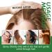 60ml Hair Growth Serum Women Hair Growth Essential Oil Natural Hair Growth Spray Hair Growth Oil for Hair Loss Hair Loss Treatment for Women Hair Serum for Dry Damaged Hair Hair Oil for Hair Growth - Buy Online on GoSupps.com