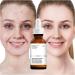 Retinol 0.2% in Squalane Retinol Serum for Face Retinol Serum Efficiently Skincare Face Serum for Women Anti Aging Serum for Reduce Fine Lines Facial Moisturiser Collagen Serum for Face facial serum - Buy Online on GoSupps.com