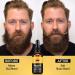 Youpo Beard Growth Oil for Men | 30ml Moisturizing Natural Beard Softener & Mustache Strengthener - Buy Online on GoSupps.com