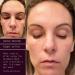 SolaWave 4-in-1 Facial Wand & Renew Complex Serum Bundle | Red Light Therapy & Microcurrent Device for Anti-Aging | Face Massager with Anti-Wrinkle Serum - Matte Black - Buy Online on GoSupps.com