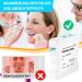 Buy Aisely Tooth Sandpaper - 2 Dental Polishing Strips 4mm Wide 6m Roll - Interdental Grinding Tools for Polishing Teeth - Blue - Buy Online on GoSupps.com