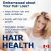 Promise Beauty Biotin High Potency Capsules 300 Capsules 10 000 mcg - Vitamin B7 for Rapid Hair Growth Support and Healthy Metabolism- Soft Skin and Strong Nails- Made In Canada 1 count (Pack of 300) - Buy Online on GoSupps.com