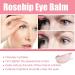 Rose Glow & Get It Cooling Eye Balm | Dark Circle Treatment | Hydrating & Brightening | On-the-go Solution - Buy Online on GoSupps.com