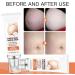 Stretch Mark Cream - Body Skin Care - Body Oil for Women - Firming & Lifting Body Oil - Stretch Marks Removal Skin Care Oil - Improves the Appearance of Stretch Marks Restore Skin Elasticity Body Oil - Buy Online on GoSupps.com