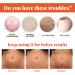 Stretch Mark Repair Essential Oil - 2/3/4PCS Pregnancy & Postpartum Scar Treatment | Prevent & Remove Stretch Marks - Buy Online on GoSupps.com