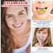 SP-8 Ultra Whitening Toothpaste - Probiotic Brightening & Fresh Breath - 2PCS - 240g for Stain Removal - Buy Online on GoSupps.com