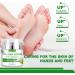 Coconut With 10% Urea Foot Cream Foot Cream For Cracked Heels And Dry Skin Cracked Heel Repair Cream With Coconut Urea Cream For Hydrating Skin Smooth Soften Hand & Foot Moisturiser - Buy Online on GoSupps.com