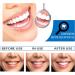 Dazzlewhite Teeth Whitening Essence - Intensive Stain Removal Gel for Sensitive Teeth (3PCS) | Reduce Yellowing & Achieve a Brighter Smile - Buy Online on GoSupps.com