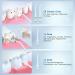 Bestope Wireless Oral Shower for Teeth - 250ml Portable & Rechargeable 4 Nozzle Tips IPX7 Waterproof - Perfect for Home & Travel - Buy Online on GoSupps.com
