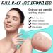5 Pcs Exfoliating Back Scrubber Set with Handles - Shower Body Scrubber for Women Men - Cleans Skin, Massages, Exfoliates - One Size - Buy Online on GoSupps.com