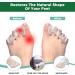 Toe Separators for Bunions - Pain Relief & Corrective Toe Spacers for Men & Women - Clear Toe Straighteners for Hammer Toe & Foot Alignment - 1 Pair - Buy Online on GoSupps.com