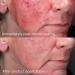 IMAGE Skincare DAILY PREVENTION Advanced Smart Blend Mineral Face Moisturiser SPF 50+ Sunscreen Lotion Reduces Redness and Evens Skin Tone 48 g - Buy Online on GoSupps.com