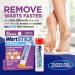 WartStick Wart Remover 0.2 oz (Pack of 4) - Fast-Acting Solution for Removing Warts - Buy Online on GoSupps.com