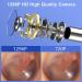 VITCOCO Ear Wax Removal Kit with 1296P Camera - Waterproof Endoscope for iPhone, iPad, Android - Ear Cleaner Tool - Buy Online on GoSupps.com