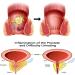 Heca Natural Herbal Hemorrhoid Capsules - Rapid Relief Treatment for Hemorrhoids - Buy Online on GoSupps.com