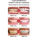 Whitening Probiotic Toothpaste | Deep Clean & Fresh Breath - SP-4 Brightening Toothpaste - Buy Online on GoSupps.com