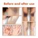 Purer Feminine Intimate Area Whitening Pink Serum & Moisturizer Set - Buy Online on GoSupps.com