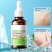 Salicylic Acid Oil Control Essence Serum | Minimize Shine & Maintain Clear Skin Shop Now - Buy Online on GoSupps.com
