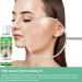 Extra Strength Peeling Oil for Dark Skin - 110ML | Chemical Peel for Face Hands & Feet - At Home Treatment - Buy Online on GoSupps.com