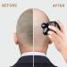 Telfun Detachable Head Shaver | Electric Head Shavers for Bald Men | 5-in-1 Cordless Razors for Men 100% Waterproof | Head Electric Razor with Nose Hair Trimmer Anti-Pinch Wet and Dry Shaving - Buy Online on GoSupps.com