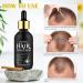 Hair Growth Serum with Biotin 100% Veganic Hair Oil 60ml Hair Growth Oil for Promote Natural Hair Growth Stop Hair Loss and Thinning and Strengthen for Hair Regrowth Nursing Scalp - Buy Online on GoSupps.com