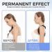 Posture Corrector for Men & Women - Adjustable Back Brace & Shoulder Support for Comfortable Clavicle Alignment - Buy Online on GoSupps.com