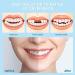 1 Piece Cosmetic Veneers - Instant Teeth Whitening Dentures for Men & Women | False Teeth Veneers for Missing Teeth - Buy Online on GoSupps.com