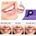 Teeth Whitening Toothpaste - Purple Stain Remover & Color Correcting Formula (2PC) - Strong Cleaning Power & Refreshing Freshness - Buy Online on GoSupps.com