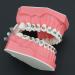 Buy 1:1 Orthodontic Model - Standard Typodont Teeth Model M7010-2 for Dental Teaching & Study | Archwire Ligature Ties Metal Brackets & Buccal Tubes - Buy Online on GoSupps.com