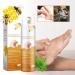 Buy Todahof Bienengift Joint Spray & Cvreoz Pain Relief Spray - Natural Beeergift Treatment for Joints (5PCs) | International Shipping Available - Buy Online on GoSupps.com