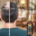 5% Minoxidil Hair Growth Serum Oil for Men & Women | Biotin Hair Serum | Prevent Scalp Hair Loss | 60ml - Buy Online on GoSupps.com