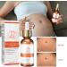 Stretch Mark Repair Essential Oil - 2/3/4PCS Pregnancy & Postpartum Scar Treatment | Prevent & Remove Stretch Marks - Buy Online on GoSupps.com