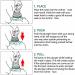 2 Set Choking Rescue Device with CPR Masks | Portable First Aid Kit for Adults & Kids | Suction Device for Fast Relief - Buy Online on GoSupps.com