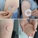 Freestyle Adhesive Patches 25 Pack for Libre2/3 Sensor Covers Tan - Waterproof, Flexible CGM Patches - No Center Glue - Enlite, Guardian, Freestyle Libre 14 Day Sensor - 25 Count - Buy Online on GoSupps.com