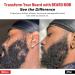 Beard Mob Growth Oil for Men | Thicker Longer Beard & Faster Growth | Paraben-Free All Skin Types | 2 Oz (Red - Buy Online on GoSupps.com