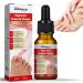 Ingrow Toenail Correction Treatment Oil Ingrown Toenail Correction Drops Cuticle Care Oils for Ingrown Toenails Nail Care and Treatment Nail Fungal Treatment (1pcs 10ml)